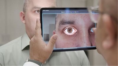 Tablet scanning the health of an eye on an adult male